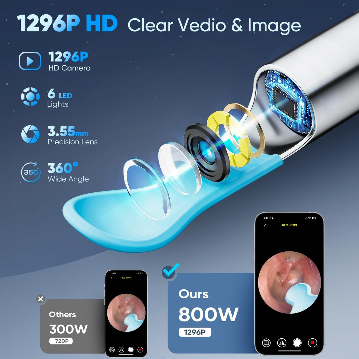 Otoscop Vizual Smart Ureche