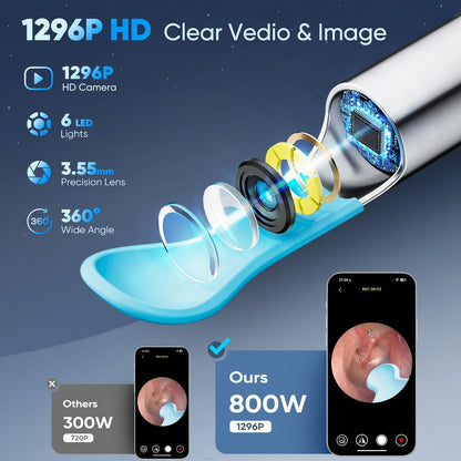 Otoscop Vizual Smart Ureche