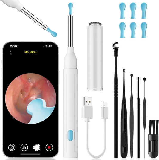 Otoscop Vizual Smart Ureche