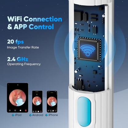 Otoscop Vizual Smart Ureche
