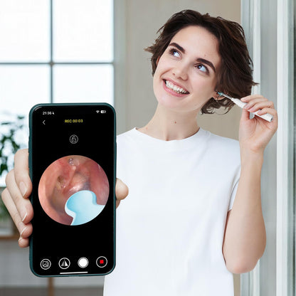 Otoscop Vizual Smart Ureche
